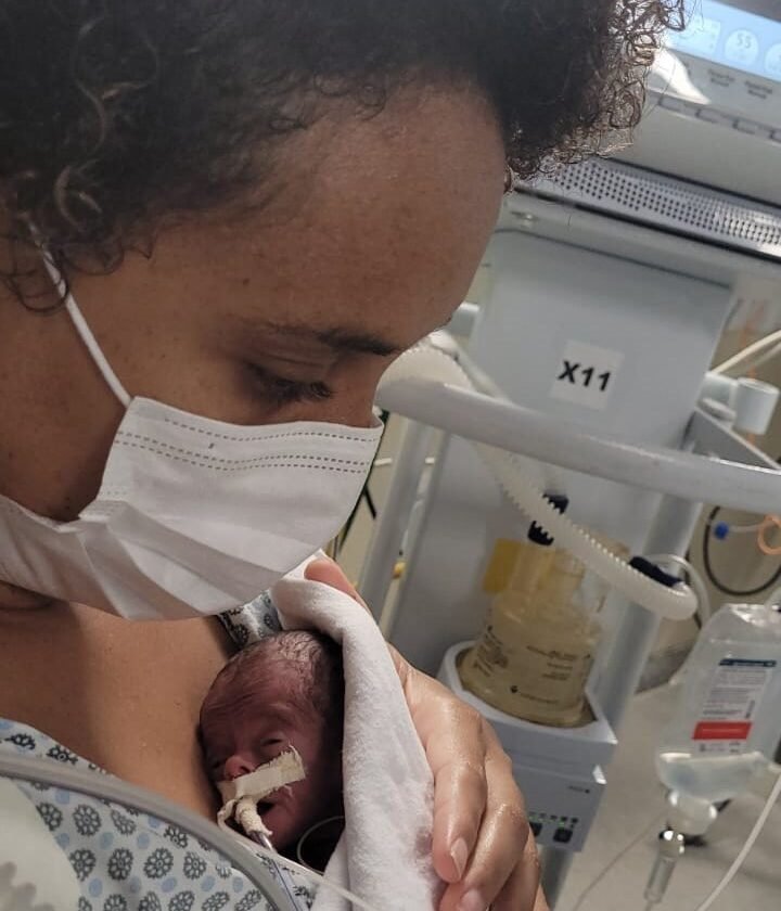 Liz, a Pequena Guerreira: bebê que nasceu com menos de 0,5 kg retorna à maternidade com 1 ano