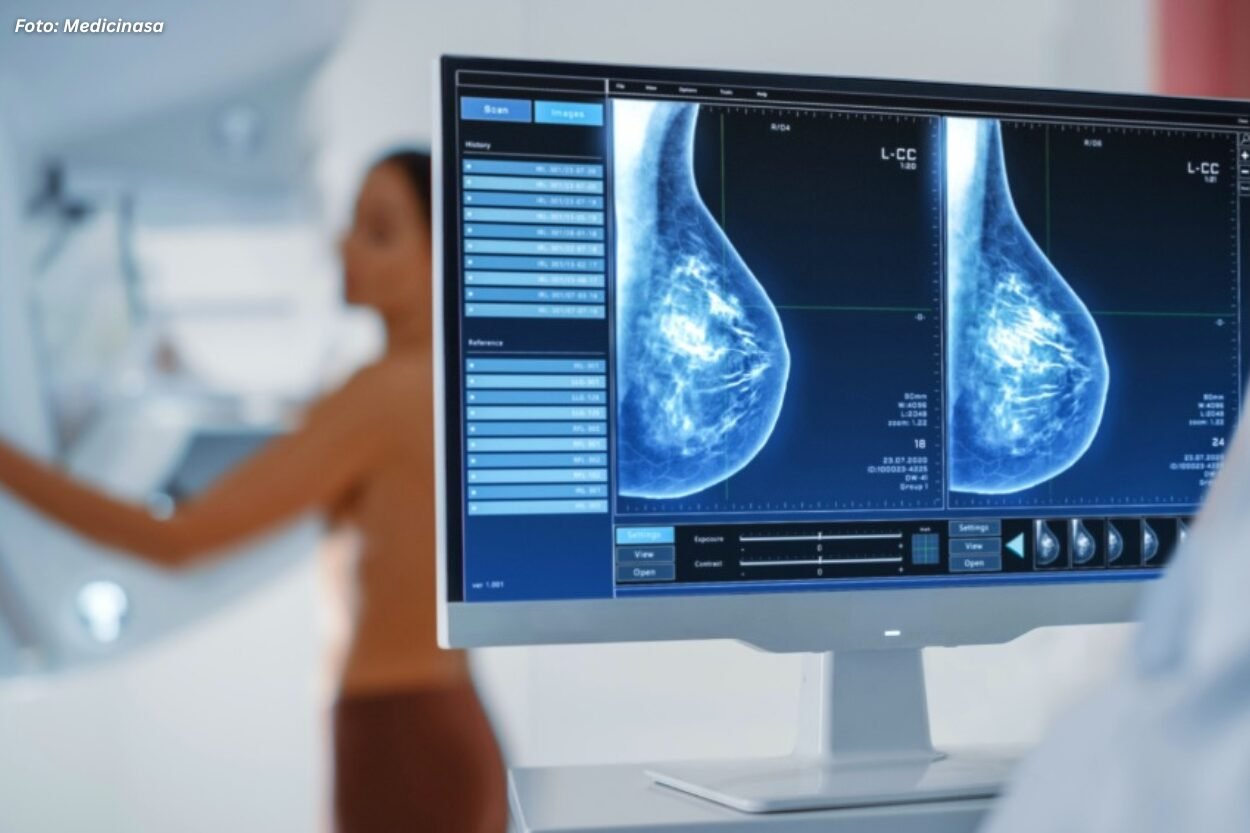 Mamografias passam a ser realizadas em Mariana