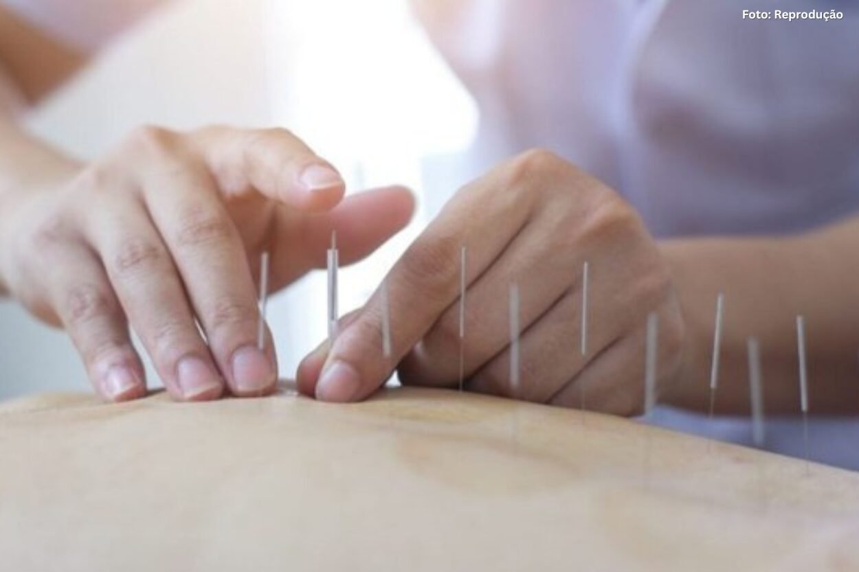 Trajetória construída em Ouro Preto ajuda a regulamentar a acupuntura no Brasil