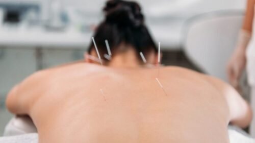 Trajetória construída em Ouro Preto ajuda a regulamentar a acupuntura no Brasil