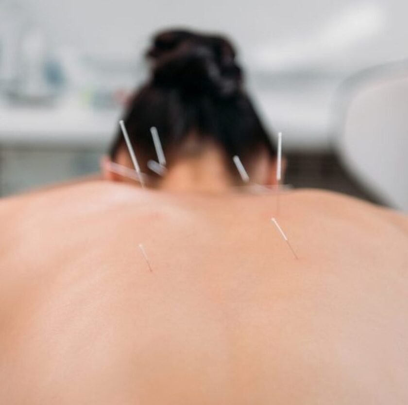 Trajetória construída em Ouro Preto ajuda a regulamentar a acupuntura no Brasil