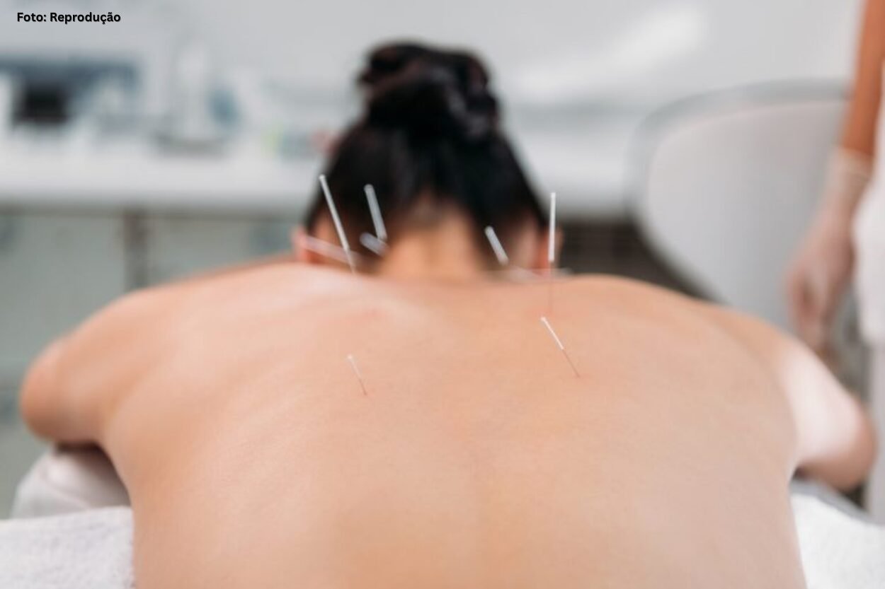 Trajetória construída em Ouro Preto ajuda a regulamentar a acupuntura no Brasil